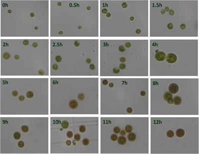 Transcription Factors From Haematococcus pluvialis Involved in the Regulation of Astaxanthin Biosynthesis Under High Light-Sodium Acetate Stress